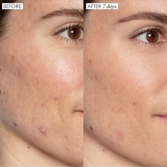 ▪️ 5/$25 SUNDAY RILEY Good Genes Lactic Acid Treatment - .17 oz NWOB - Picture 4 of 6